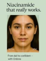 Ordona Niacinamide 10% Face Serum | For Brightening, Reduces Dark Spots & Acne Marks | Suitable for All Skin Types  (30 ml) - Image 4